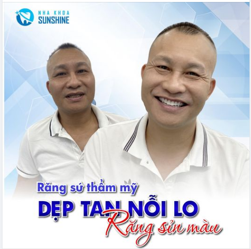 RĂNG SỨ THẨM MỸ DẸP TAN NỖI LO RĂNG SỈN MÀU