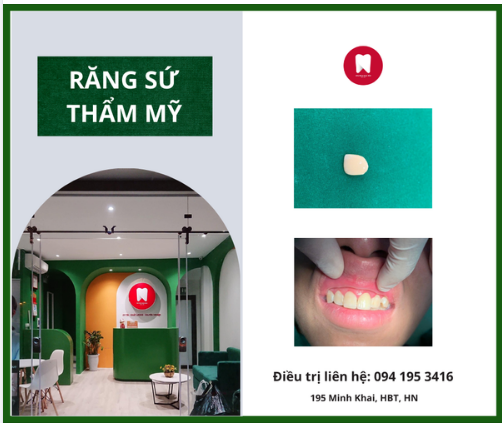 RĂNG SỨ THẨM MỸ - KHÔNG CÒN NỖI LO RĂNG NỨT GÃY