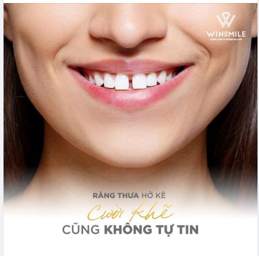 RĂNG THƯA HỞ KẼ - CƯỜI KHẼ CŨNG KHÔNG TỰ TIN