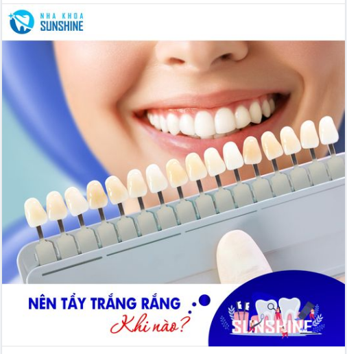 RĂNG TRẮNG BẬT TÔNG NHỜ TẨY TRẮNG RĂNG TẠI KHOA RĂNG THẨM MỸ SUNSHINE