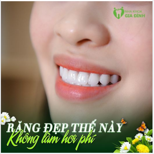 RĂNG TRẮNG XINH – NỤ CƯỜI LUNG LINH