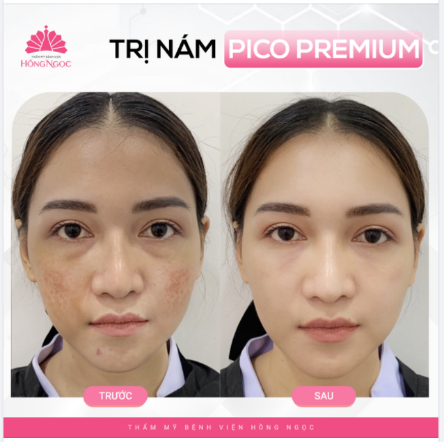 "Rất nhiều lúc, chị biết rõ quyết định đó là sai, nhưng bài toán đó lại chẳng thể có cách giải nào khác"