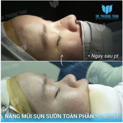 RẤT SỐC VÌ SỰ THAY ĐỔI CỦA CHÍNH MÌNH