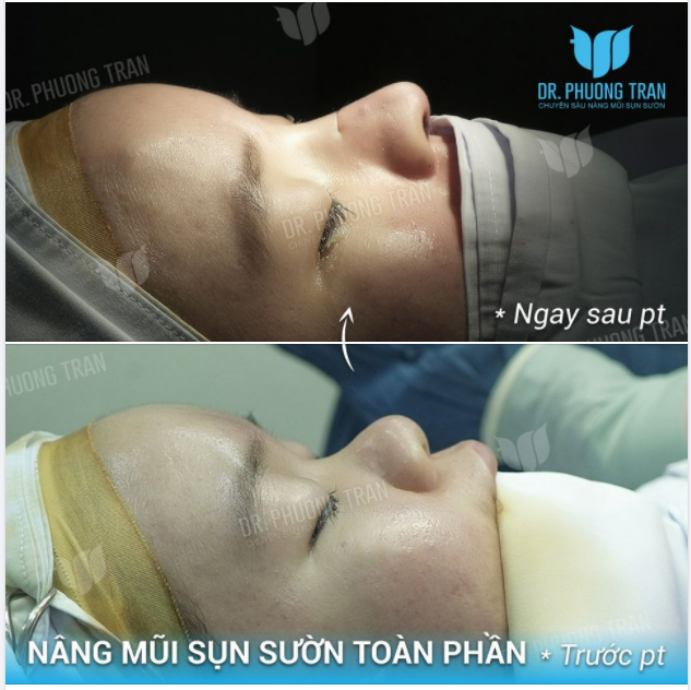 RẤT SỐC VÌ SỰ THAY ĐỔI CỦA CHÍNH MÌNH