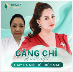 Rũ bỏ làn da " lão hóa xấu xí" để trở thành nữ hoàng tỏa sáng, độc lập và hạnh phúc! Đó là tất cả những gì mà Doanh nhân Bảo Ngọc đã đạt được sau khi thực hiện căng chỉ BIOLIFT