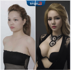 SĂN THẺ VIP - GIÁ TRỊ TRỌN ĐỜI - LỘT XÁC TOÀN DIỆN