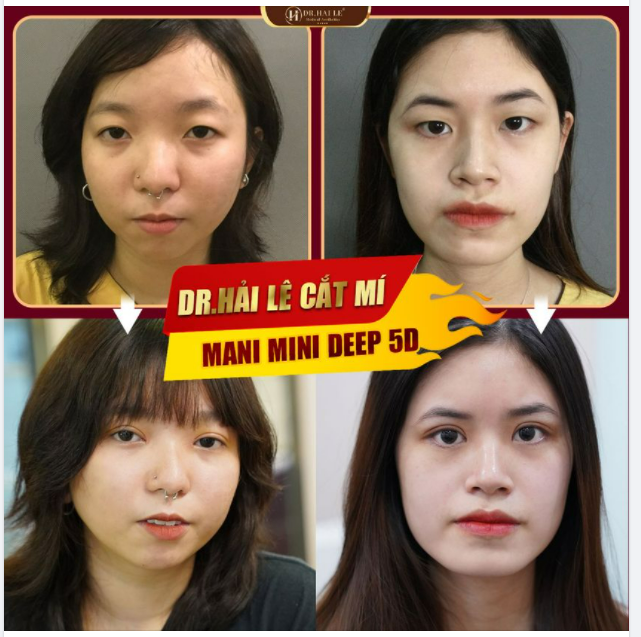 Sáng tạo thì gặp Gen - Z  Gương mặt sắc nét thì gặp Dr.Hải Lê!