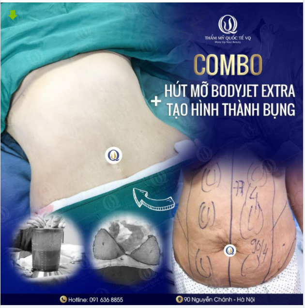 Sau 2 lần sinh nở, chị khách hàng gần như đã hết hi vọng về việc giảm cân để lấy lại vóc dáng thời thanh xuân.
