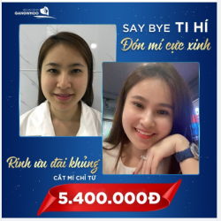 SAY BYE TI HÍ ĐÓN MÍ CỰC XINH - RINH ƯU ĐÃI KHỦNG CẮT MÍ CHỈ TỪ 5.400.000Đ