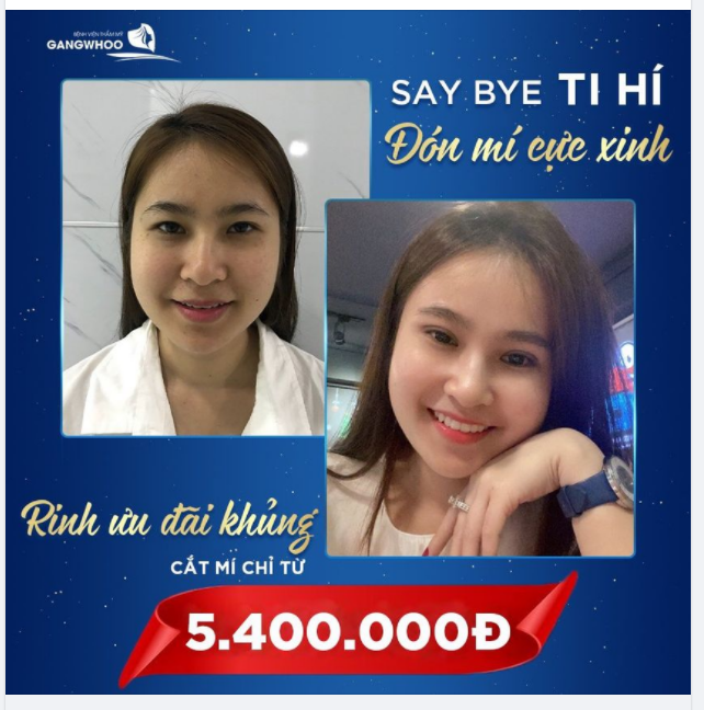 SAY BYE TI HÍ ĐÓN MÍ CỰC XINH - RINH ƯU ĐÃI KHỦNG CẮT MÍ CHỈ TỪ 5.400.000Đ