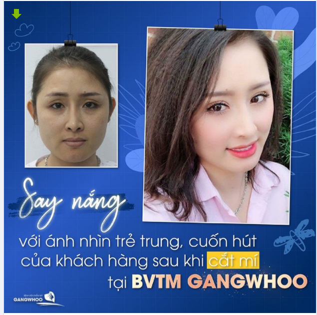 SAY NẮNG VỚI ÁNH NHÌN TRẺ TRUNG CUỐN HÚT CỦA KHÁCH HÀNG SAU KHI CẮT MÍ TẠI TM GANGWHOO