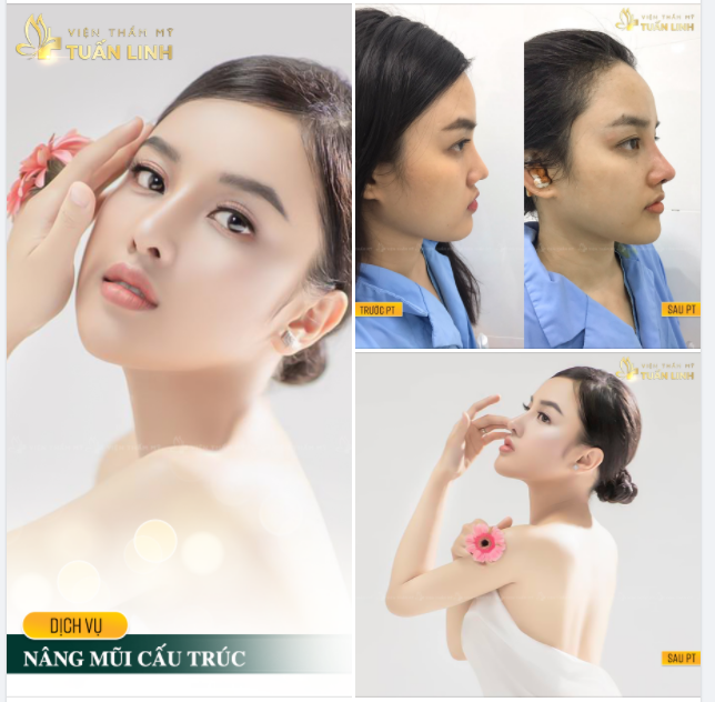 Si mê chứ ê kéo dài với dáng mũi nhà tuấn Linh