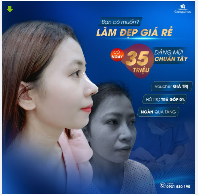 SỞ HỮU “35 TRIỆU” NHƯNG KHÔNG PHẢI TRẢ HẾT 35 TRIỆU