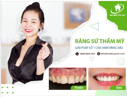 SỞ HỮU NỤ CƯỜI ĐẸP XUẤT THẦN CHỈ SAU 02 LẦN HẸN