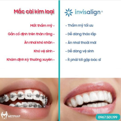 SO SÁNH NIỀNG RĂNG MẮC CÀI VÀ NIỀNG RĂNG INVISALIGN