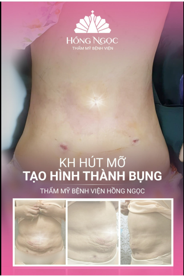 "SỒ SỀ/ XẤU XÍ" SAU SINH - VỀ NGAY TEAM HỒNG NGỌC