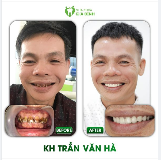 SỰ THAY ĐỔI BẤT NGỜ CỨ NGỠ CHỈ LÀ MƠ