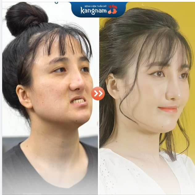 Sự thay đổi ngoạn mục cho ca HỞ HÀM ẾCH