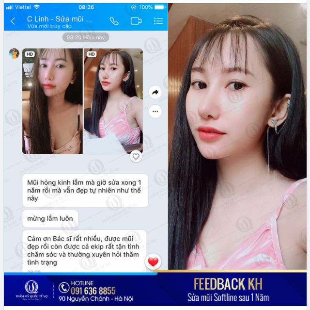 SỬA LẠI MŨI HỎNG - ĐIÊU KHẮC MŨI MỚI ĐẸP TỰ NHIÊN