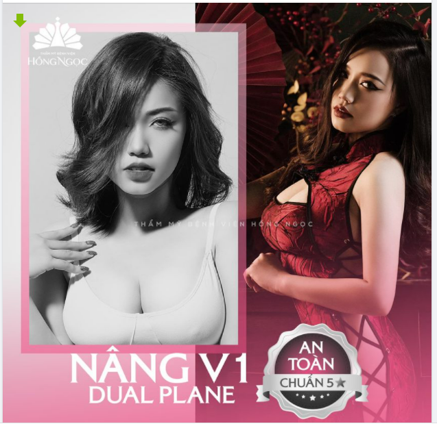 SỨC HÚT KHÓ CƯỠNG SAU NÂNG V1 DUAL PLANE