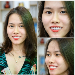 TÁI SINH NỤ CƯỜI – THĂNG HẠNG TỰ TIN