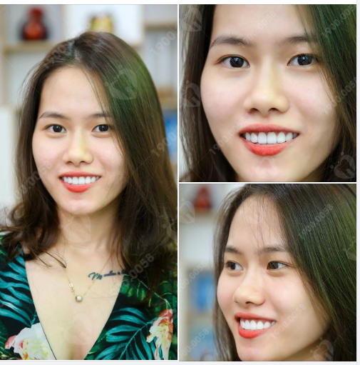 TÁI SINH NỤ CƯỜI – THĂNG HẠNG TỰ TIN