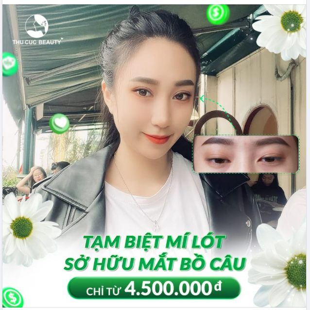TẠM BIỆT MÍ LÓT - ĐÓN MẮT BỒ CÂU