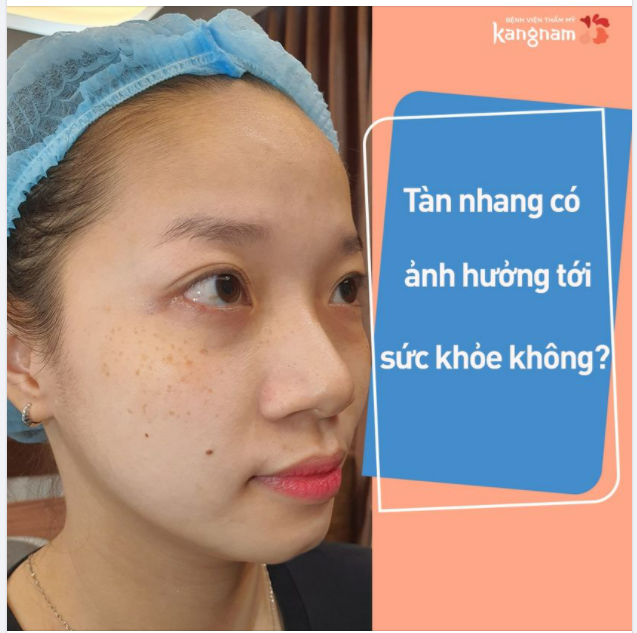 TÀN NHANG có ảnh hưởng tới sức khỏe không?