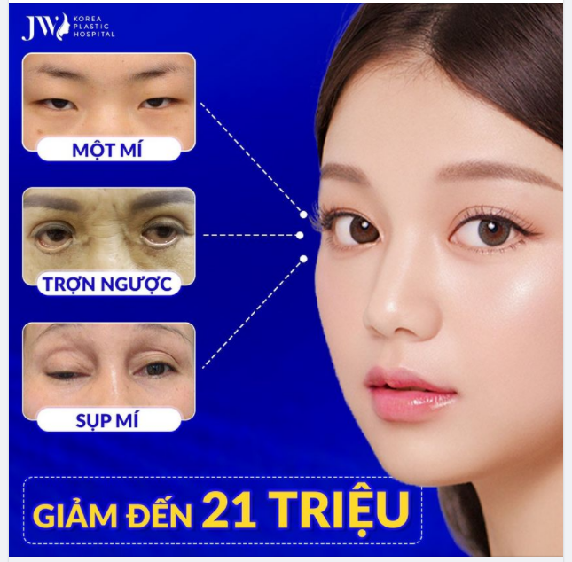 TÂN TRANG cửa sổ tâm hồn MẮT HAI MÍ đẹp lồng lộn CHUẨN MỸ NHÂN