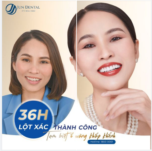 TÂN TRANG NỤ CƯỜI - ĐIỂM 10 THẦN THÁI