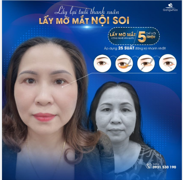 TĂNG SỨC HÚT VỚI ĐÔI MẮT SÁNG LONG LANH