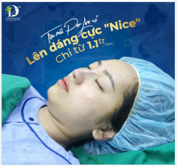 Tậu mũi Per-Line 4.0 - Lên dáng cực "nice".