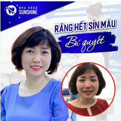 TẨY TRẮNG RĂNG WHITEMAX  GIẢI PHÁP NHANH NHẤT CHO NỤ CƯỜI