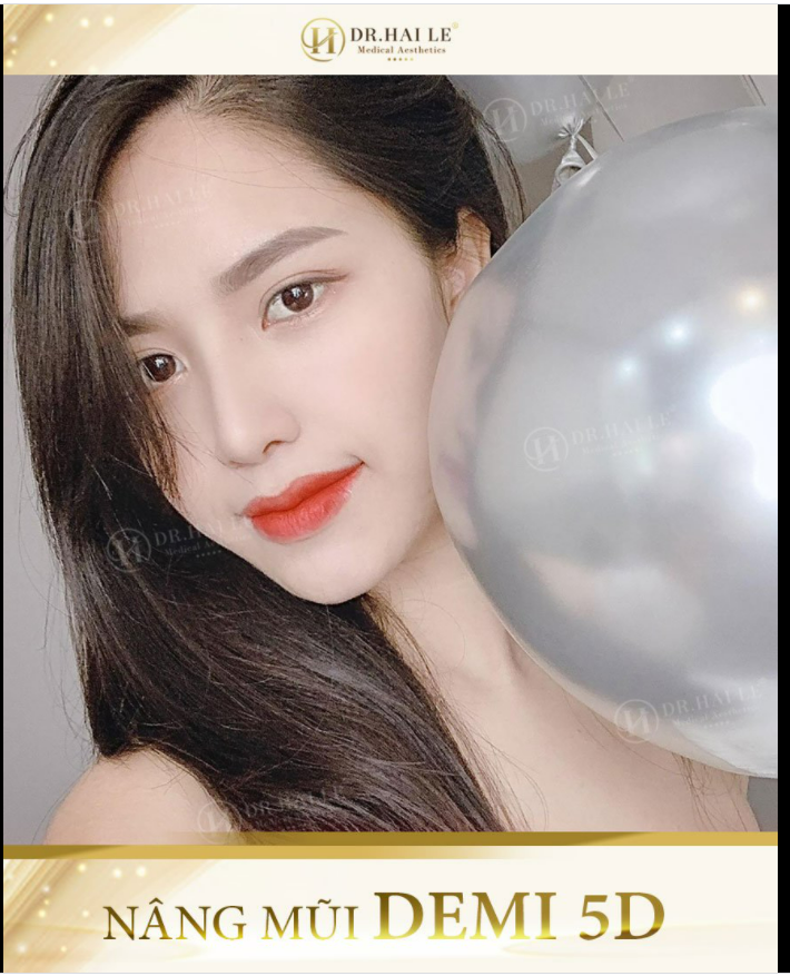 THẢ NHẸ 1 CHÚT THÍNH CHIỀU NAY Dáng mũi gần 2 năm tuổi ƯNG HẾT SỨC.