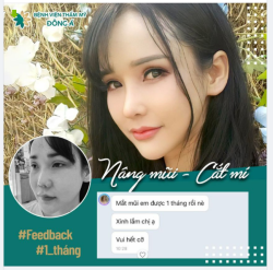 Thần thái rạng ngời sau 1 tháng Nâng Mũi - Cắt Mí tại ĐÔNG Á