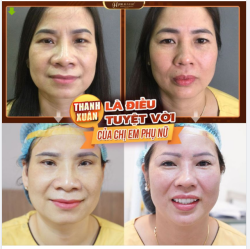 Thanh xuân là gì? Tại sao chúng ta luôn muốn nó trường tồn?