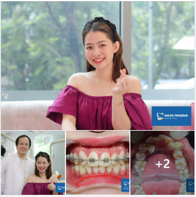 "THÁO NIỀNG RỒI VUI QUÁ MỌI NGƯỜIII ƠIIIIIII