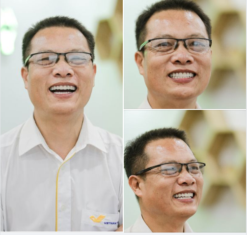 THAY ĐỔI NỤ CƯỜI – RẠNG NGỜI PHONG ĐỘ