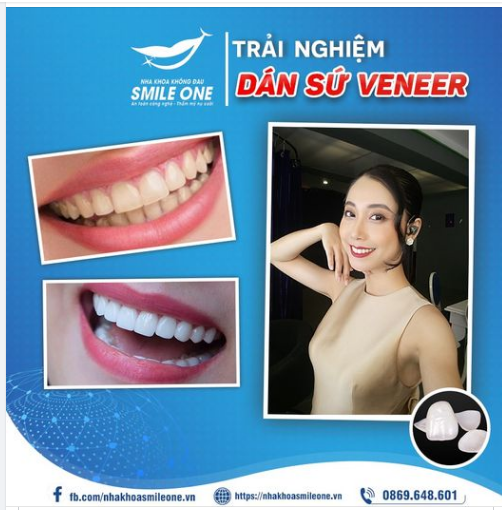 THAY ĐỔI TOÀN DIỆN - HOÀN THIỆN NỤ CƯỜI