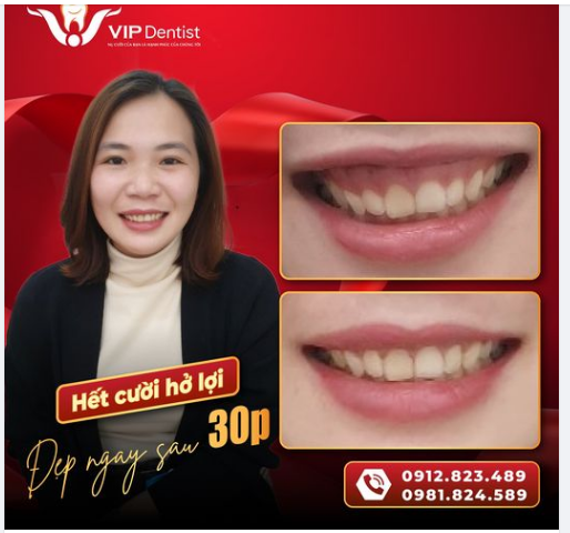 THÊM MỘT NỤ CƯỜI TÌM ĐƯỢC NÉT ĐẸP ĐÍCH THỰC