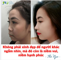 Thiếu nữ 9X được bạn bè ưu ái gọi “ HOTGIRL TÂY ĐÔ” sau khi NÂNG MŨI SLINE