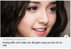 Thời gian phục hồi sau cắt mí diễn ra nhanh hay chậm phụ thuộc rất nhiều vào cách chăm sóc mắt sau cắt mí của chính khách hàng.