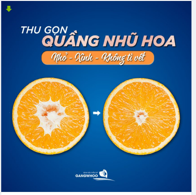 THU GỌN QUẦNG NHŨ HOA – NHỎ, XINH, KHÔNG TÙY VẾT