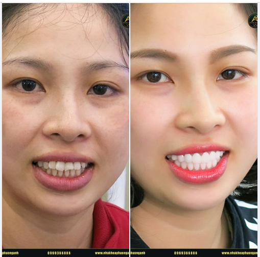 Thực ra, cùng là một người, chứ không phải chị và em