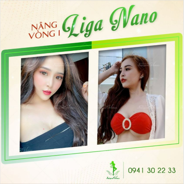 TIẾT KIỆM 30 TRIỆU KHI NÂNG V1 LIGA NANO