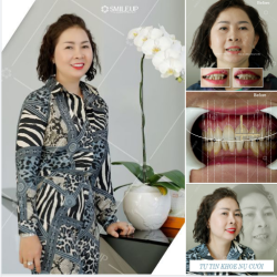 TÌM LẠI CẢ THANH XUÂN VỚI NỤ CƯỜI ĐẸP KHÔNG TÌ VẾT