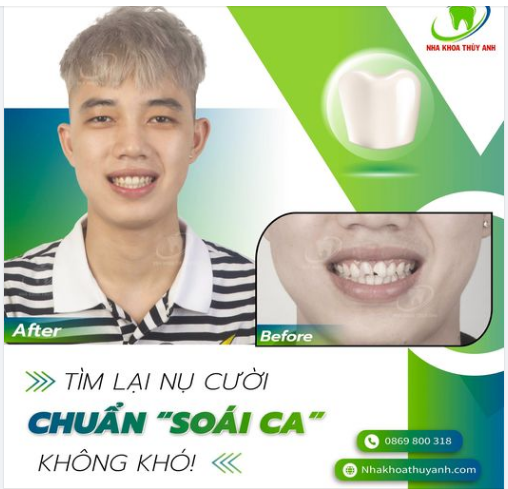 TÌM LẠI NỤ CƯỜI "CHUẨN SOÁI CA" KHÔNG HỀ KHÓ