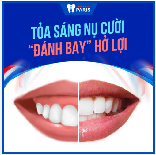 Tỏa sáng nụ cười, "đánh bay" hở lợi