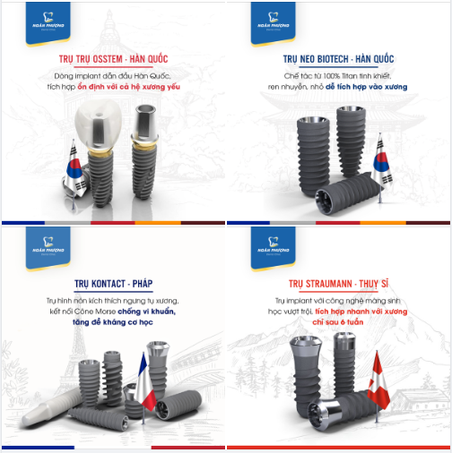 TỔNG HỢP 4 LOẠI TRỤ IMPLANT HÀNG ĐẦU THẾ GIỚI