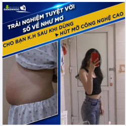 TRẢI NGHIỆM TUYỆT VỜI - SỐ VỀ NHƯ MƠ CHO BẠN K.H SAU KHI DÙNG HÚT MỠ CÔNG NGHỆ CAO